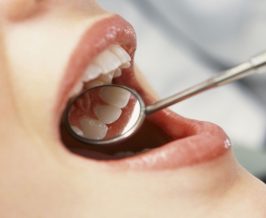 Anorexia and bulimia affect teeth