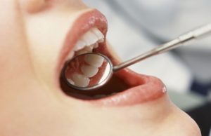 Anorexia and bulimia affect teeth