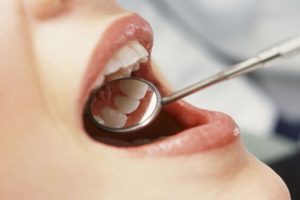 Anorexia and bulimia affect teeth